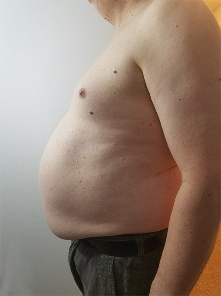 CardioMender, MD Has One of the Few Physicians Board Certified In Obesity Medicine on Staff