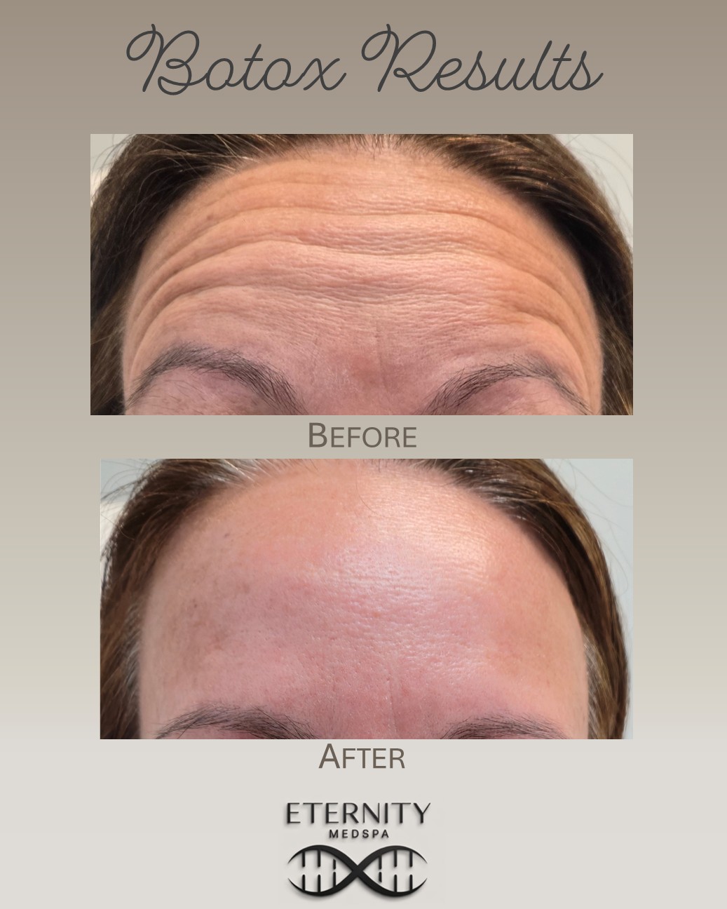 Botox treatment consultation at Eternity Medspa — smooth, natural results