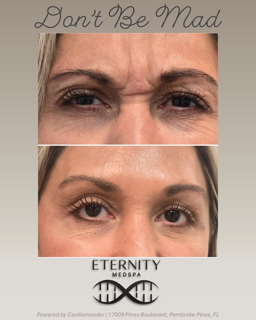 Botox crow's feet treatment — smooth skin at Eternity Medspa